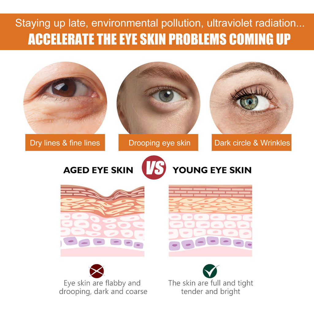 Turmeric Vitamin C Eye Cream – Reduces Eye Lines & Dark Circles